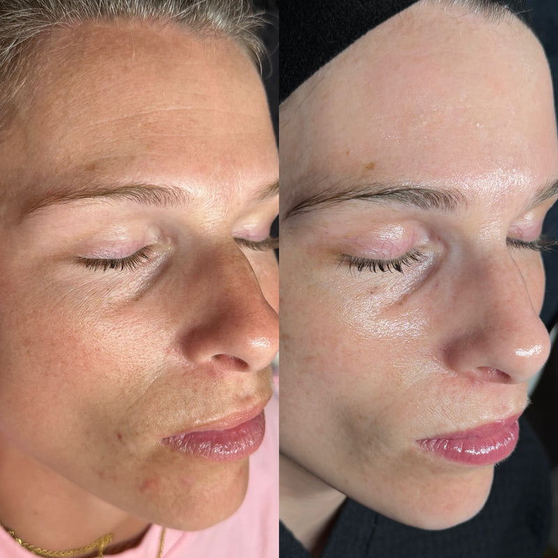 Before and after