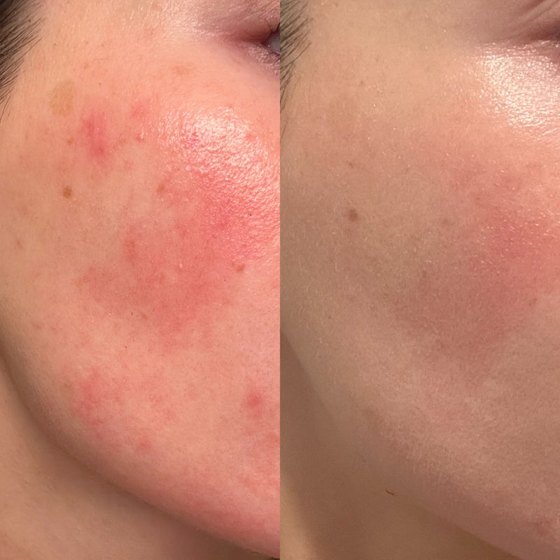 Before and after