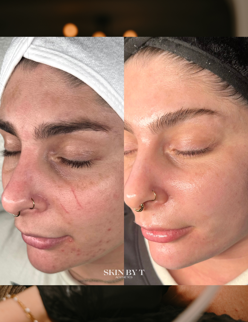 Before and after