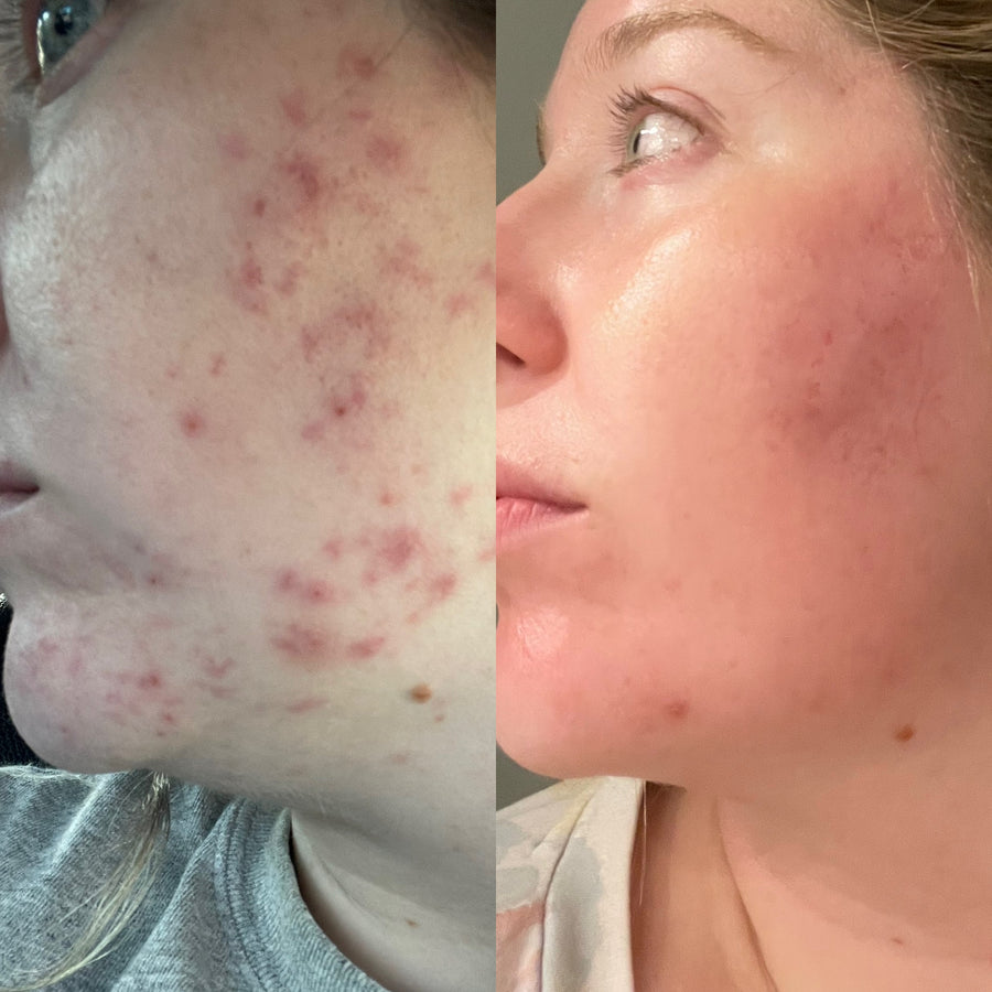 Before and after