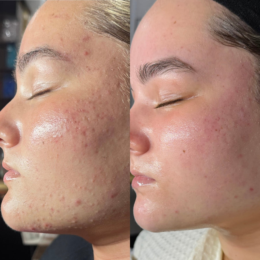 Before and after