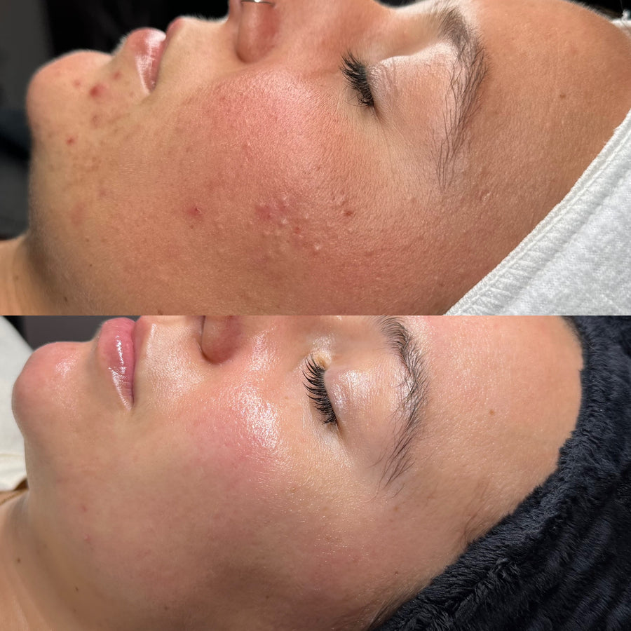 Before and after