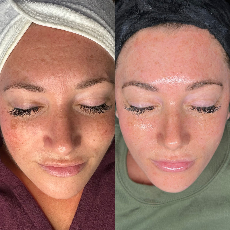 Before and after