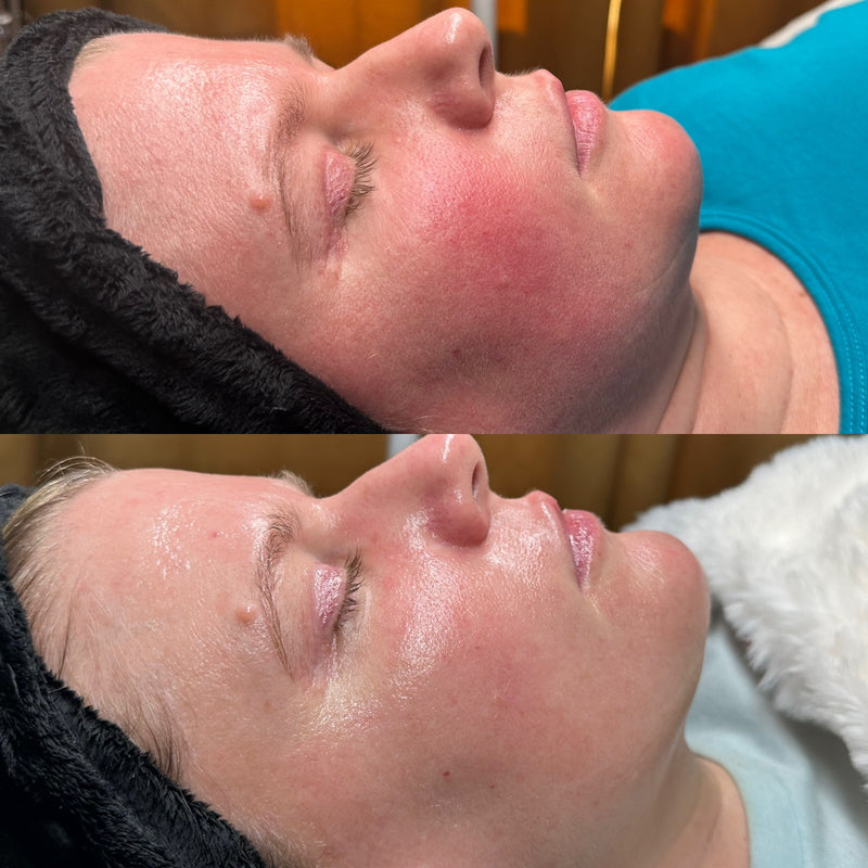 Before and after