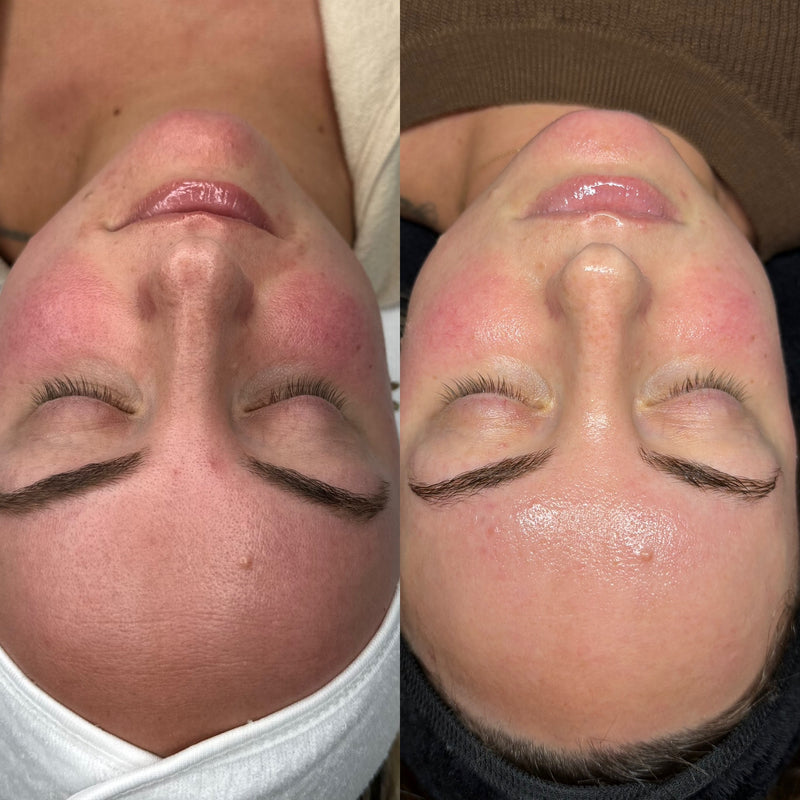 Before and after