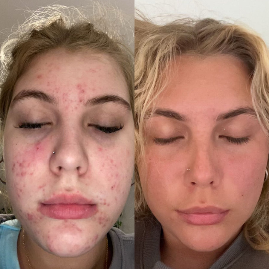 Before and after