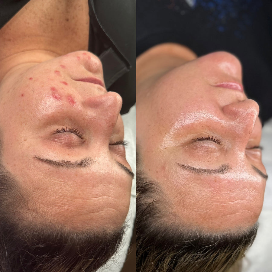 Before and after