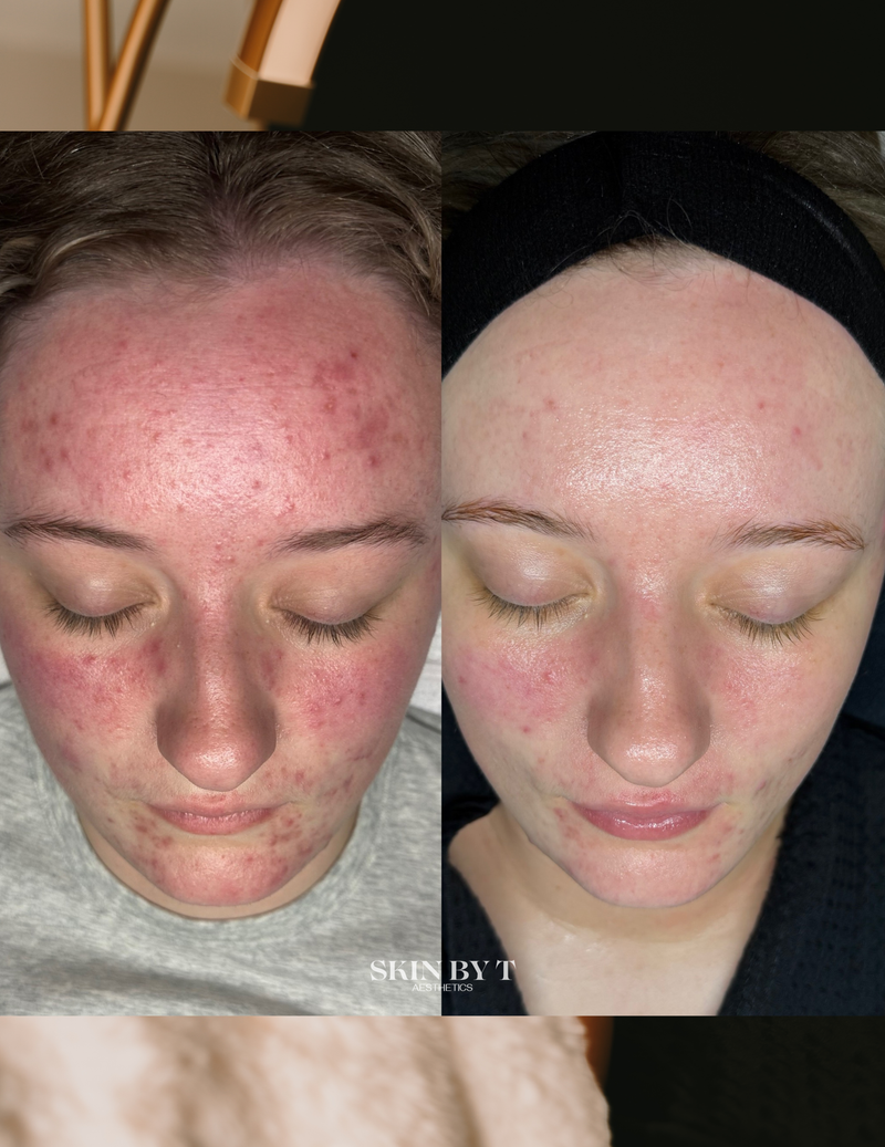 Before and after