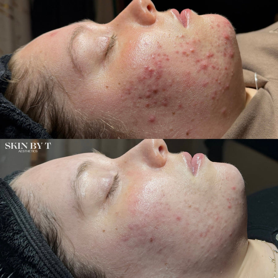 Before and after